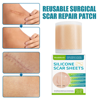 Self-adhesive Silicone Scar Paster Repair And Care Beauty Stickers